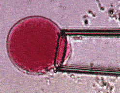 Micropippette aspiration of a vacuole Micropippette aspiration of a vacuole
